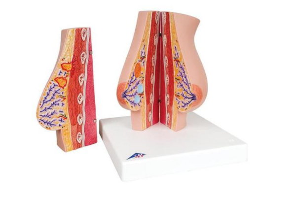 model kobiecych piersi ze zdrową i niezdrową tkanką - 3b smart anatomy kat. 1008497 l56 3b scientific modele anatomiczne 2
